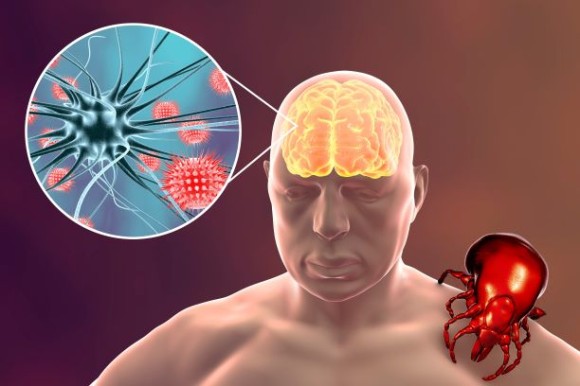 Očkování proti klíšťové encefalitidě - ALARMUJÍCÍ NÁRŮST ONEMOCNĚNÍ ZA ROK 2024. OČKUJME SE !